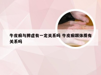 牛皮癣与脾虚有一定关系吗 牛皮癣跟体质有关系吗