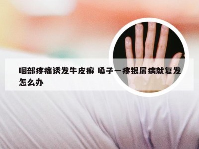 咽部疼痛诱发牛皮癣 嗓子一疼银屑病就复发怎么办