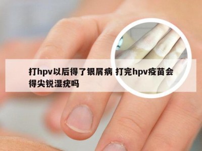 打hpv以后得了银屑病 打完hpv疫苗会得尖锐湿疣吗