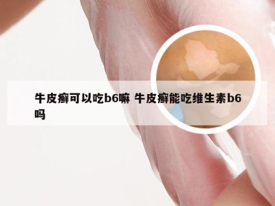 牛皮癣可以吃b6嘛 牛皮癣能吃维生素b6吗