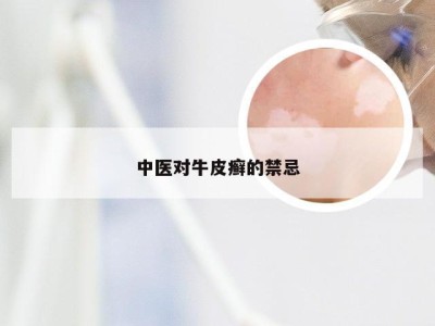 中医对牛皮癣的禁忌