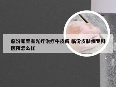 临汾哪里有光疗治疗牛皮癣 临汾皮肤病专科医院怎么样