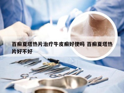 百癣夏塔热片治疗牛皮癣好使吗 百癣夏塔热片好不好