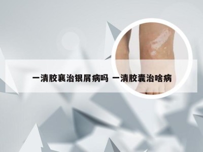 一清胶襄治银屑病吗 一清胶囊治啥病