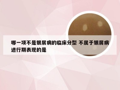 哪一项不是银屑病的临床分型 不属于银屑病进行期表现的是