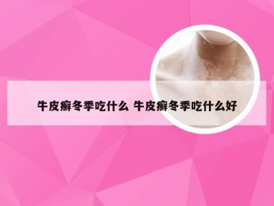 牛皮癣冬季吃什么 牛皮癣冬季吃什么好