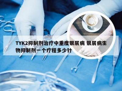 TYK2抑制剂治疗中重度银屑病 银屑病生物抑制剂一个疗程多少针