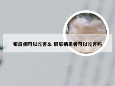 银屑病可以吃杏么 银屑病患者可以吃杏吗