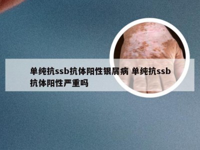 单纯抗ssb抗体阳性银屑病 单纯抗ssb抗体阳性严重吗