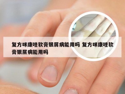 复方咪康唑软膏银屑病能用吗 复方咪康唑软膏银屑病能用吗