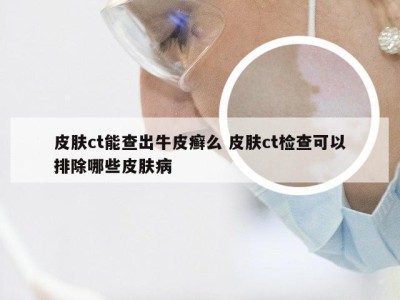 皮肤ct能查出牛皮癣么 皮肤ct检查可以排除哪些皮肤病
