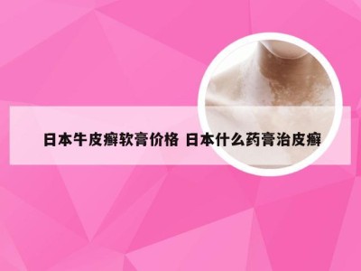 日本牛皮癣软膏价格 日本什么药膏治皮癣
