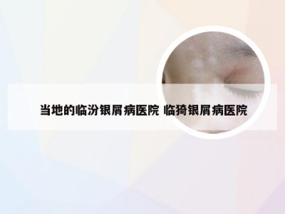 当地的临汾银屑病医院 临猗银屑病医院