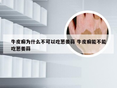 牛皮癣为什么不可以吃葱姜蒜 牛皮癣能不能吃葱姜蒜