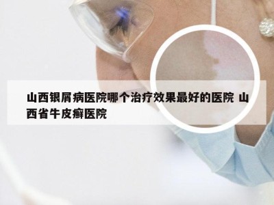 山西银屑病医院哪个治疗效果最好的医院 山西省牛皮癣医院