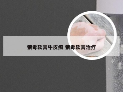 狼毒软膏牛皮癣 狼毒软膏治疗