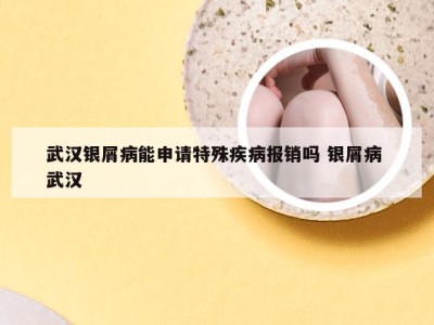 武汉银屑病能申请特殊疾病报销吗 银屑病 武汉
