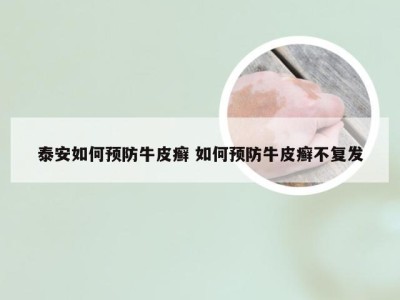泰安如何预防牛皮癣 如何预防牛皮癣不复发
