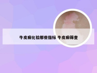 牛皮癣化验那些指标 牛皮癣筛查
