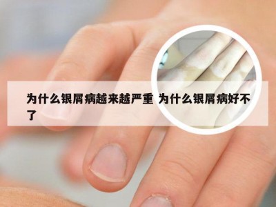 为什么银屑病越来越严重 为什么银屑病好不了