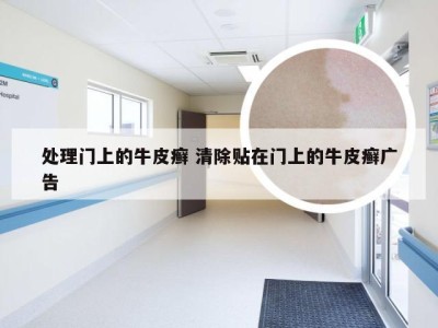 处理门上的牛皮癣 清除贴在门上的牛皮癣广告