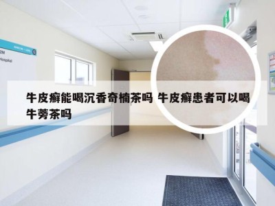 牛皮癣能喝沉香奇楠茶吗 牛皮癣患者可以喝牛蒡茶吗