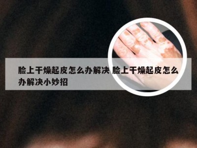 脸上干燥起皮怎么办解决 脸上干燥起皮怎么办解决小妙招