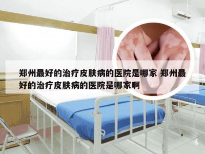郑州最好的治疗皮肤病的医院是哪家 郑州最好的治疗皮肤病的医院是哪家啊