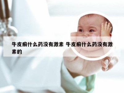 牛皮癣什么药没有激素 牛皮癣什么药没有激素的