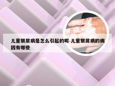 儿童银屑病是怎么引起的呢 儿童银屑病的病因有哪些