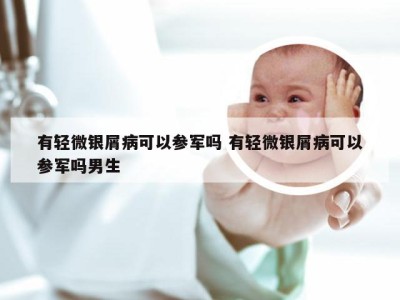 有轻微银屑病可以参军吗 有轻微银屑病可以参军吗男生