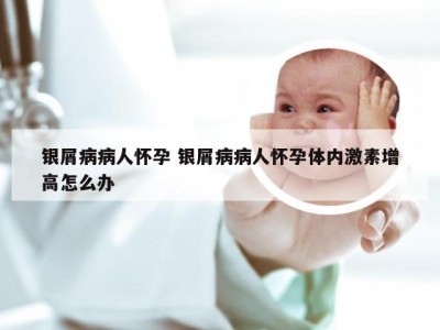 银屑病病人怀孕 银屑病病人怀孕体内激素增高怎么办