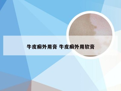牛皮癣外用膏 牛皮癣外用软膏