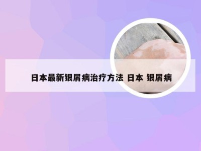 日本最新银屑病治疗方法 日本 银屑病