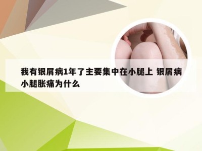 我有银屑病1年了主要集中在小腿上 银屑病小腿胀痛为什么