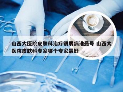 山西大医院皮肤科治疗银屑病谁最号 山西大医院皮肤科专家哪个专家最好