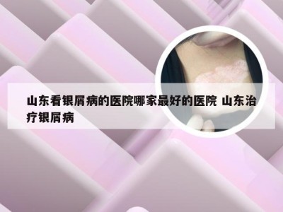山东看银屑病的医院哪家最好的医院 山东治疗银屑病