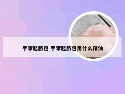 手掌起脓包 手掌起脓包用什么精油