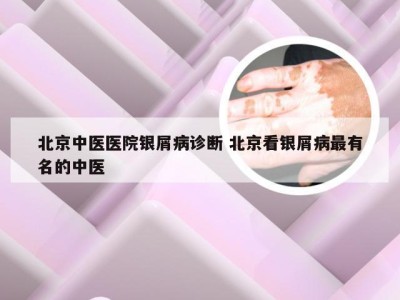 北京中医医院银屑病诊断 北京看银屑病最有名的中医