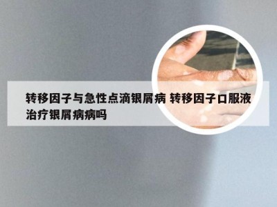 转移因子与急性点滴银屑病 转移因子口服液治疗银屑病病吗