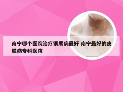 南宁哪个医院治疗银屑病最好 南宁最好的皮肤病专科医院