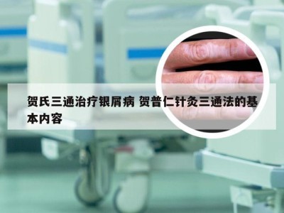 贺氏三通治疗银屑病 贺普仁针灸三通法的基本内容