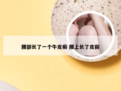 腰部长了一个牛皮癣 腰上长了皮藓