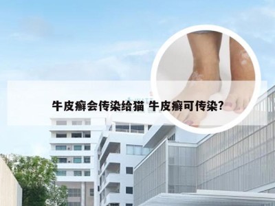 牛皮癣会传染给猫 牛皮癣可传染?