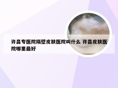 许昌专医院隔壁皮肤医院叫什么 许昌皮肤医院哪里最好