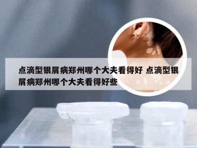 点滴型银屑病郑州哪个大夫看得好 点滴型银屑病郑州哪个大夫看得好些