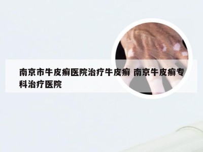 南京市牛皮癣医院治疗牛皮癣 南京牛皮癣专科治疗医院