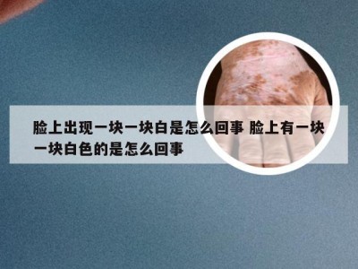 脸上出现一块一块白是怎么回事 脸上有一块一块白色的是怎么回事