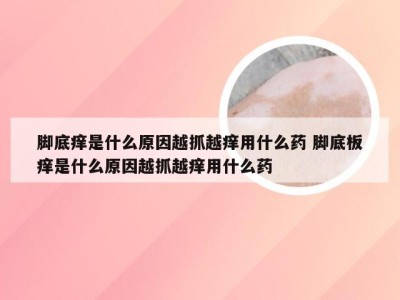 脚底痒是什么原因越抓越痒用什么药 脚底板痒是什么原因越抓越痒用什么药