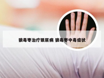 狼毒枣治疗银屑病 狼毒枣中毒症状
